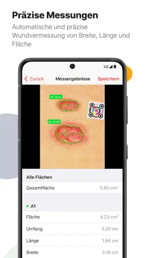 imitoWound - Wunddokumentation screenshot 3