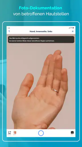 Neurodermitis App Nia screenshot 10