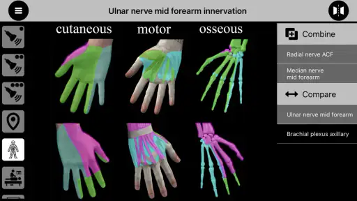 AnSo Anaesthesia Sonoanatomy screenshot 11