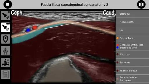 AnSo Anaesthesia Sonoanatomy screenshot 12