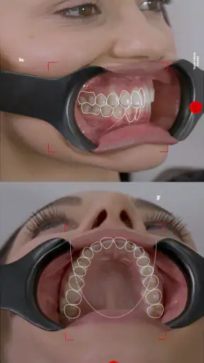 Dental Shooting screenshot 10
