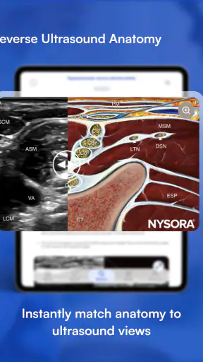 NYSORA Nerve Blocks screenshot 10