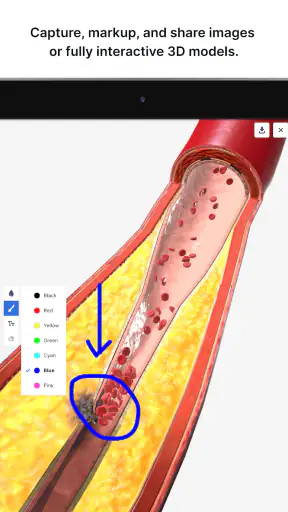 BioDigital Human - 3D Anatomy screenshot 11