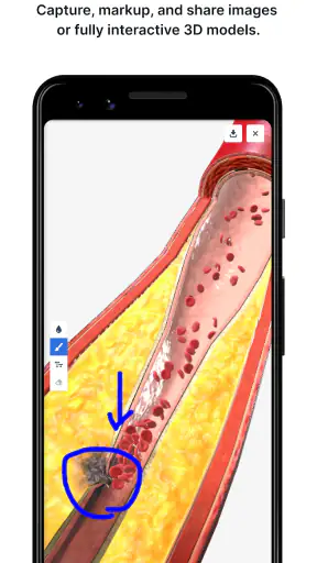 BioDigital Human - 3D Anatomy screenshot 5