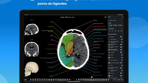 IMAIOS e-Anatomy screenshot 10