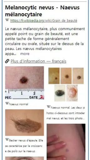 Model Derm – Maladie de peau screenshot 2