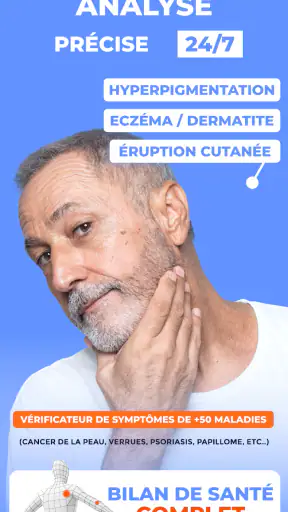 Scanner santé peau: Skinive AI screenshot 2