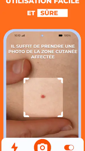 Scanner santé peau: Skinive AI screenshot 3