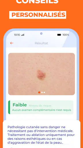 Scanner santé peau: Skinive AI screenshot 5