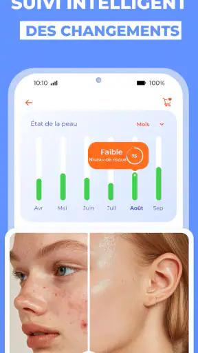 Scanner santé peau: Skinive AI screenshot 6