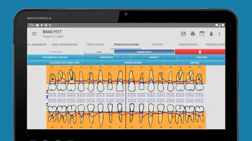 Cusp Dental Software screenshot 10