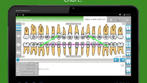 Cusp Dental Software screenshot 9