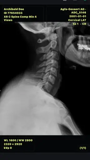 DICOM Viewer screenshot 4