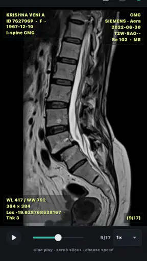 DICOM Viewer screenshot 6