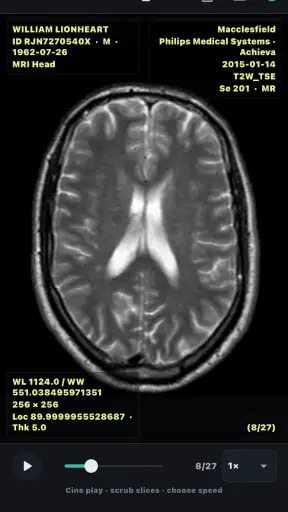 DICOM Viewer screenshot 7