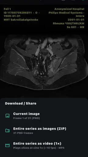 DICOM Viewer screenshot 8