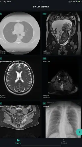 DICOM Viewer screenshot 9