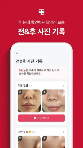 에이지알 - 메디큐브 디지털클리닉 AGE-R screenshot 3